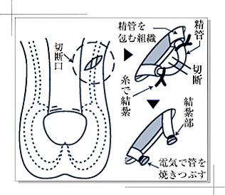 カット 射精 パイプ