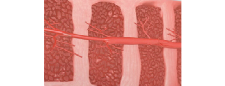 新しい血管を形成する細胞増殖因子の放出