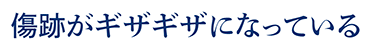 傷跡がギザギザになっている